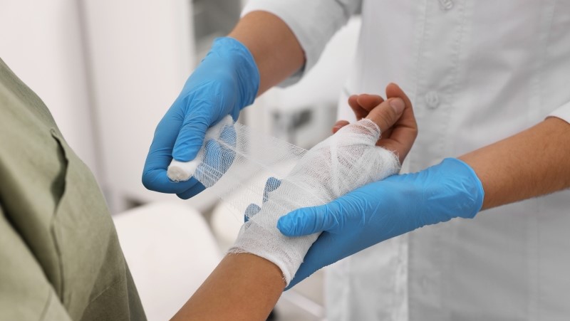Doctor bandaging patient's burned hand indoors